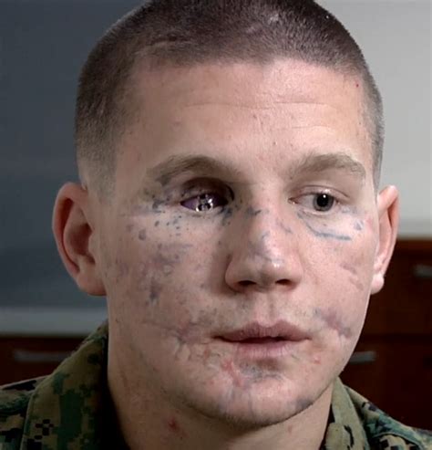 William kyle carpenter - Carpenter remained living and missing flesh and an eye. Carpenter was deployed to Afghanistan in 2010 with not much communication with family. Kyle Carpenter was a marine and a medal of honor recipient. Carpenter had received this great award for the heroic act he had done or achieved. Carpenter had risked his life by covering a frag, with his ... 